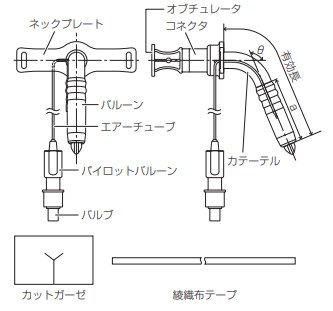 気管切開チューブ